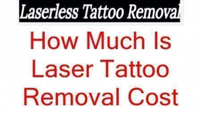 What Is The Cost Of Tattoo Removal – Value Is Not Only Money